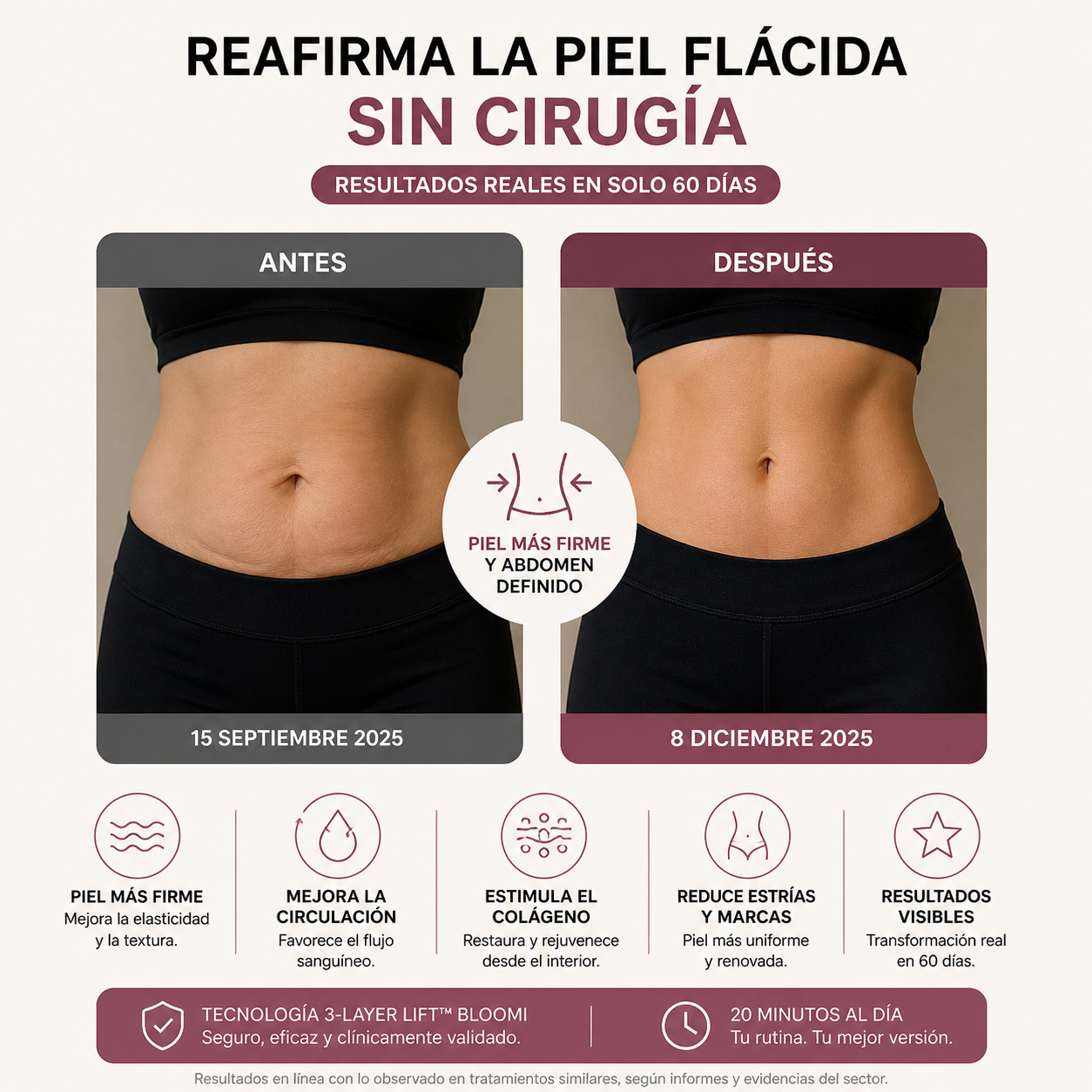 FAJA DE LUZ ROJA SLIMORA REAFIRMANTE ABDOMINAL